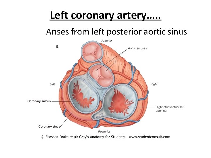 Left coronary artery…. . Arises from left posterior aortic sinus 