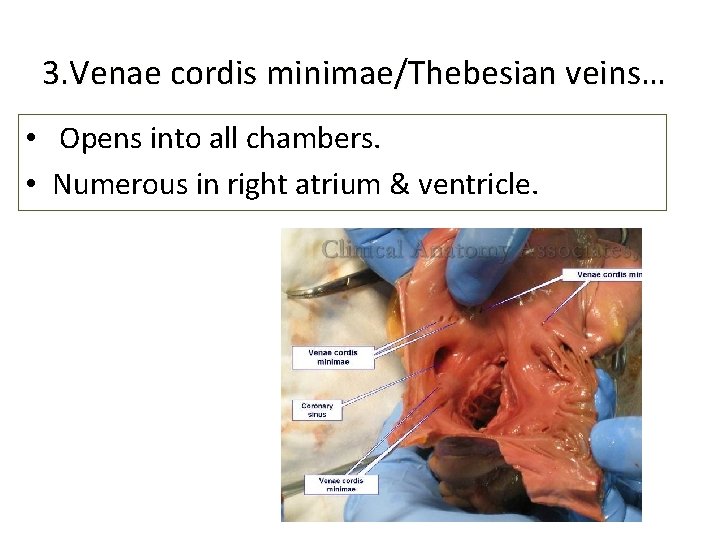 3. Venae cordis minimae/Thebesian veins… • Opens into all chambers. • Numerous in right