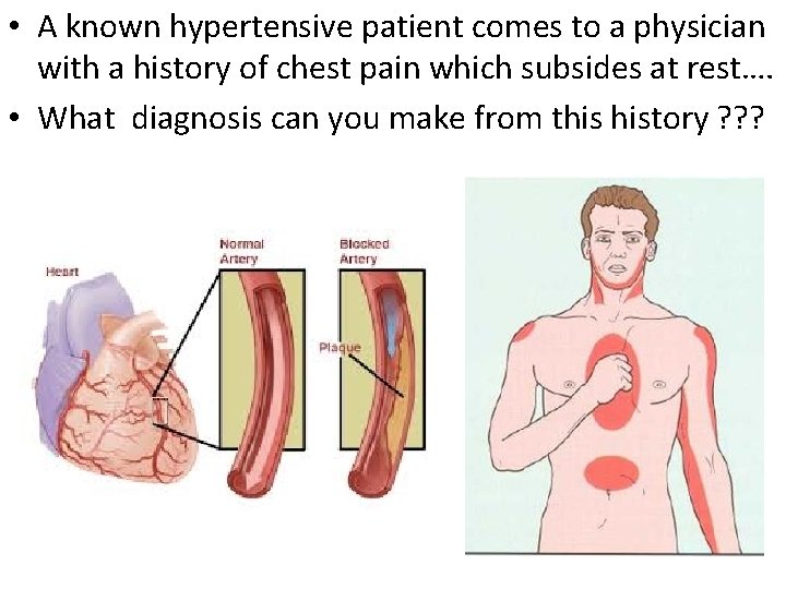  • A known hypertensive patient comes to a physician with a history of