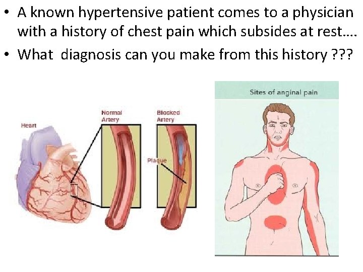  • A known hypertensive patient comes to a physician with a history of