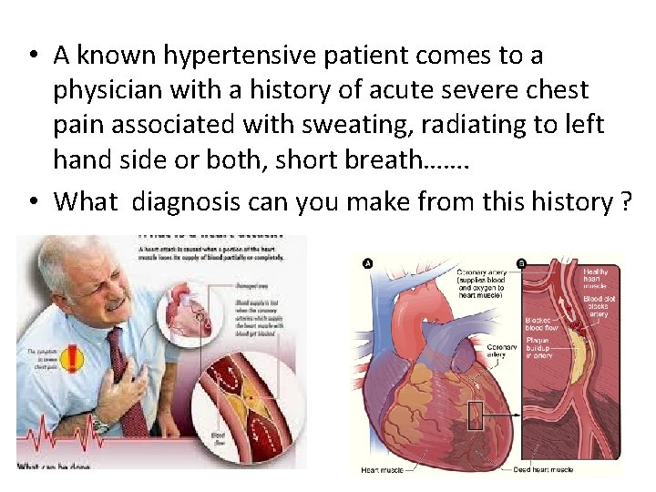  • A known hypertensive patient comes to a physician with a history of