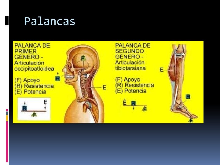 Palancas 