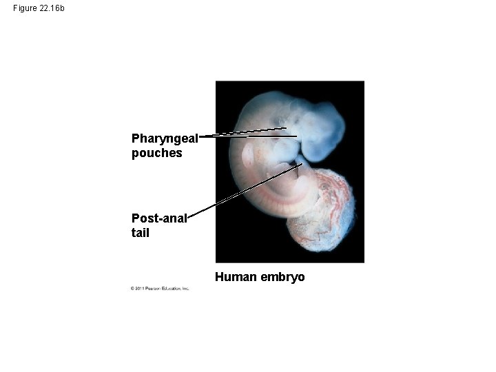 Figure 22. 16 b Pharyngeal pouches Post-anal tail Human embryo 