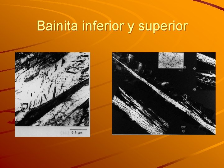 Bainita inferior y superior 