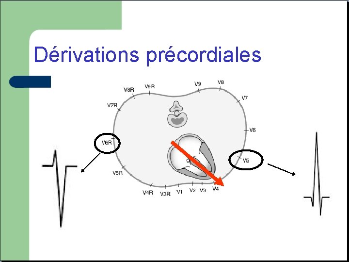 Dérivations précordiales 