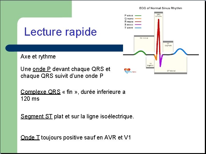 Lecture rapide Axe et rythme Une onde P devant chaque QRS et chaque QRS