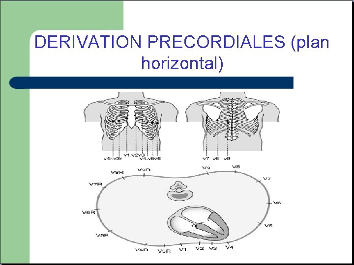 DERIVATION PRECORDIALES (plan horizontal) 