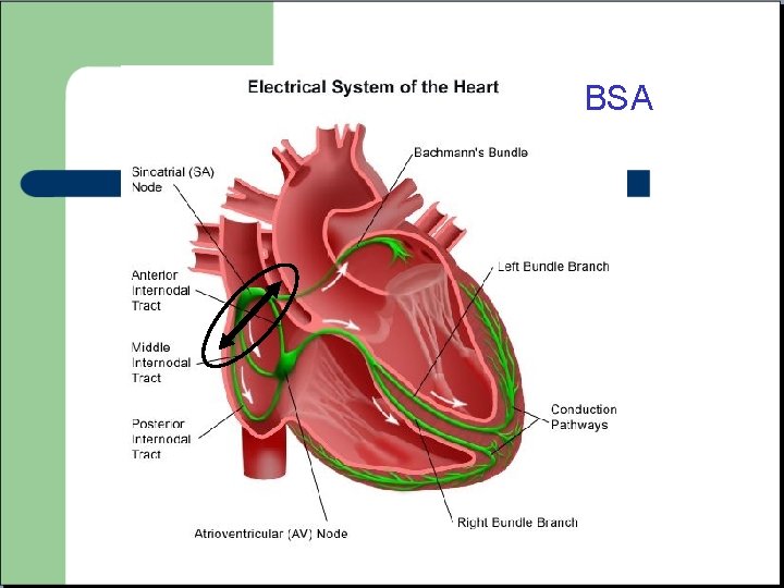 BSA 