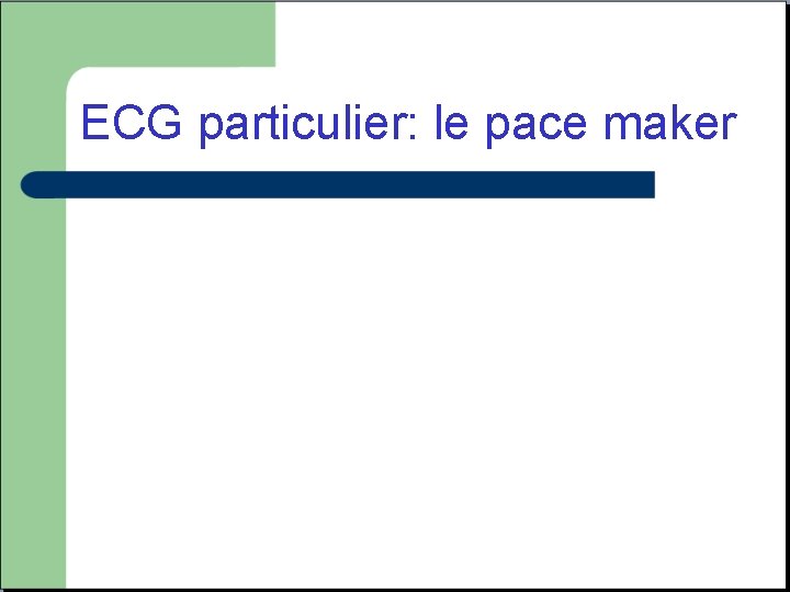 ECG particulier: le pace maker 