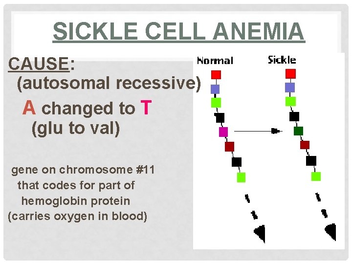 SICKLE CELL ANEMIA CAUSE: (autosomal recessive) A changed to T (glu to val) gene