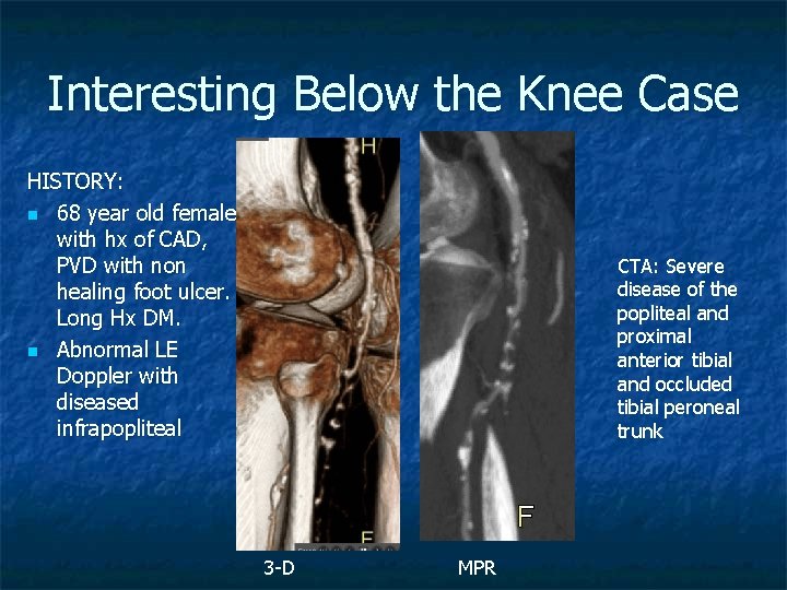 Interesting Below the Knee Case HISTORY: n 68 year old female with hx of