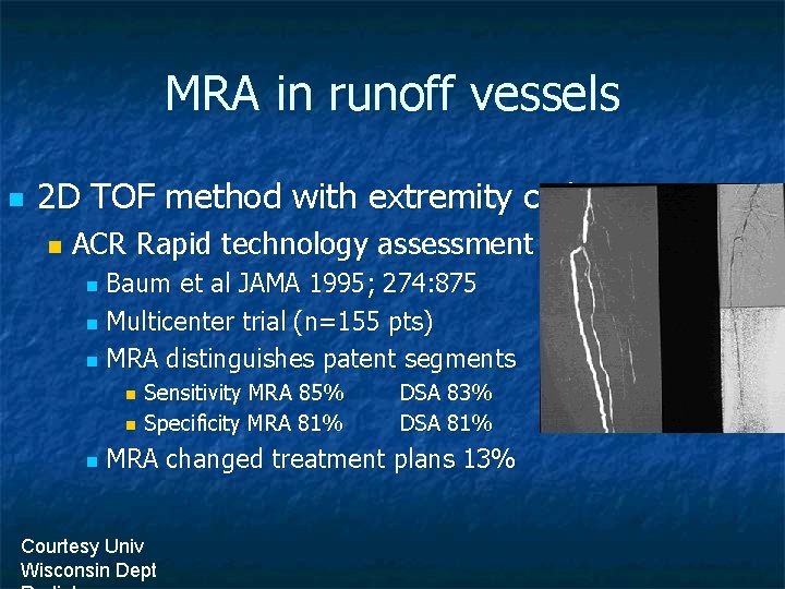 MRA in runoff vessels n 2 D TOF method with extremity coil n ACR