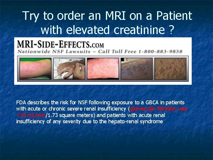 Try to order an MRI on a Patient with elevated creatinine ? FDA describes
