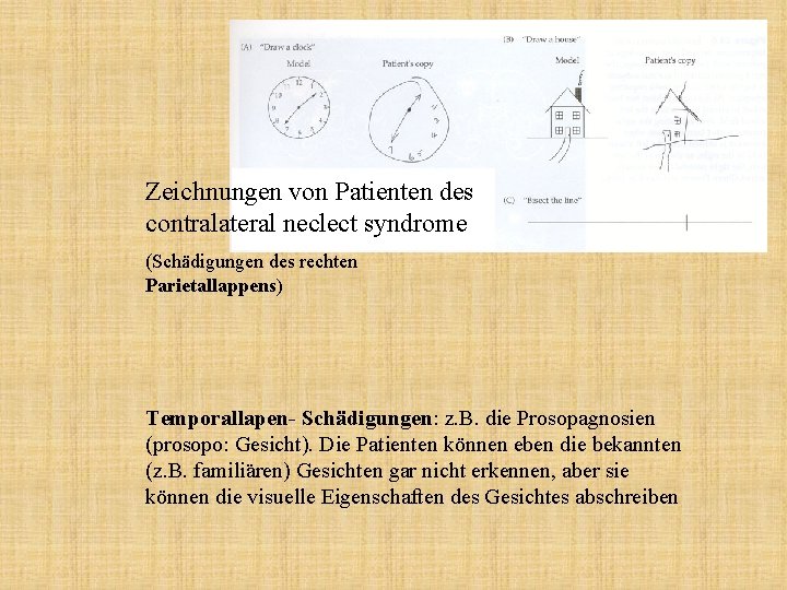 Zeichnungen von Patienten des contralateral neclect syndrome (Schädigungen des rechten Parietallappens) Temporallapen- Schädigungen: z.