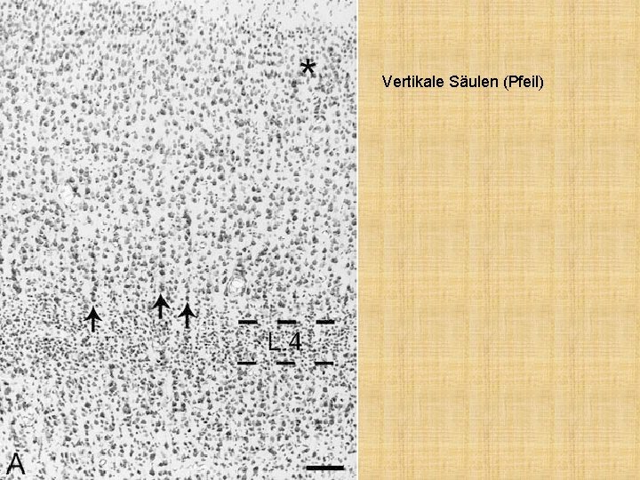 Vertikale Säulen (Pfeil) 