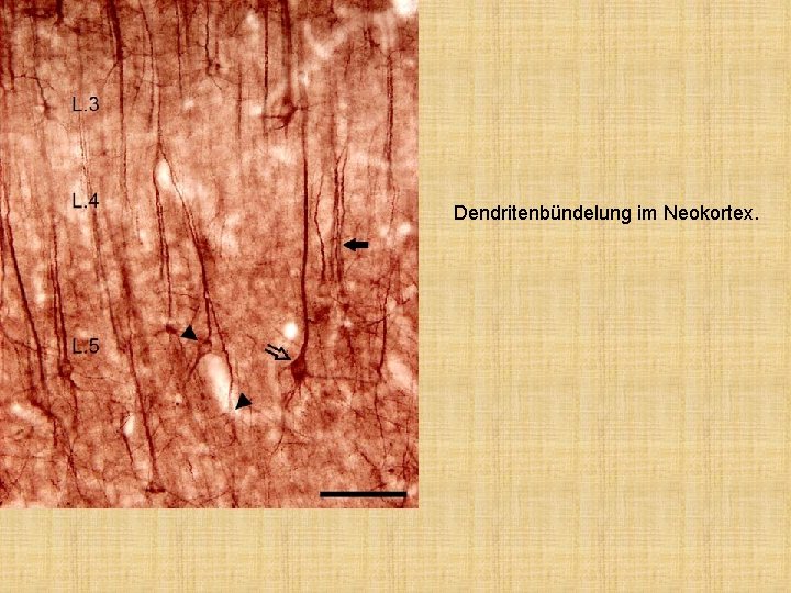 Dendritenbündelung im Neokortex. 