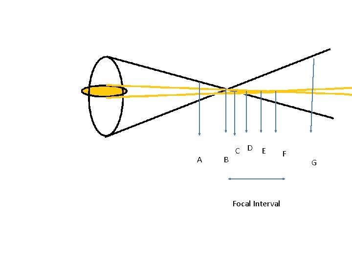 A B C D E Focal Interval F G 