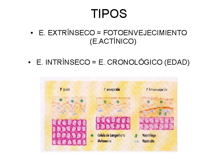 TIPOS • E. EXTRÍNSECO = FOTOENVEJECIMIENTO (E. ACTÍNICO) • E. INTRÍNSECO = E. CRONOLÓGICO