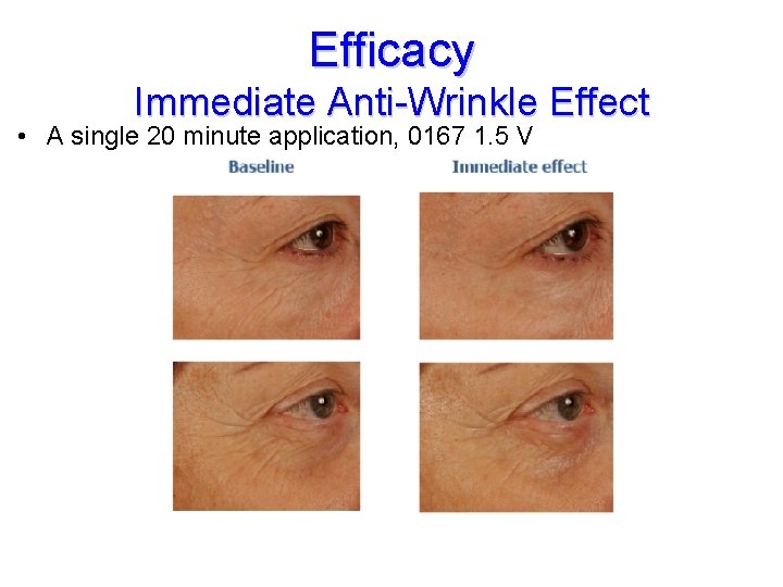 Efficacy Immediate Anti-Wrinkle Effect • A single 20 minute application, 0167 1. 5 V