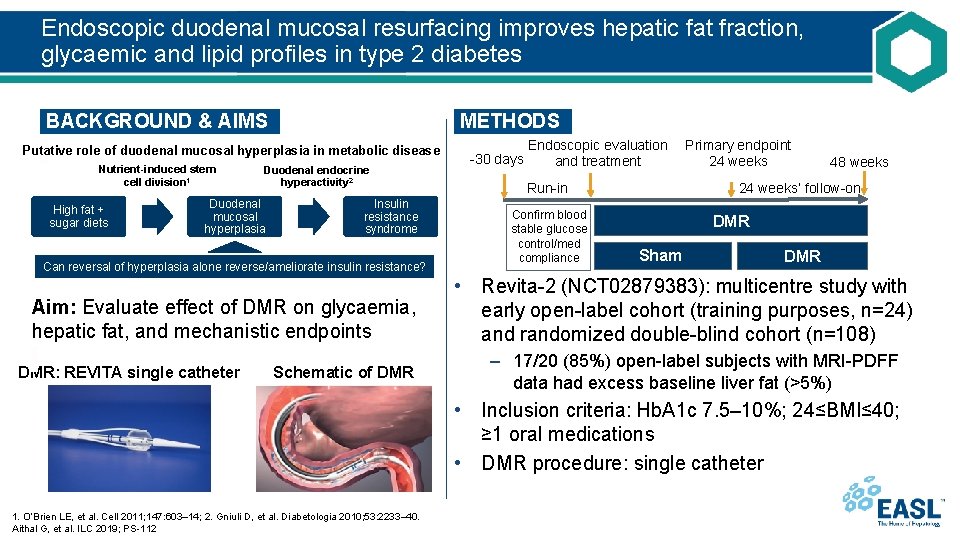 Endoscopic duodenal mucosal resurfacing improves hepatic fat fraction, glycaemic and lipid profiles in type