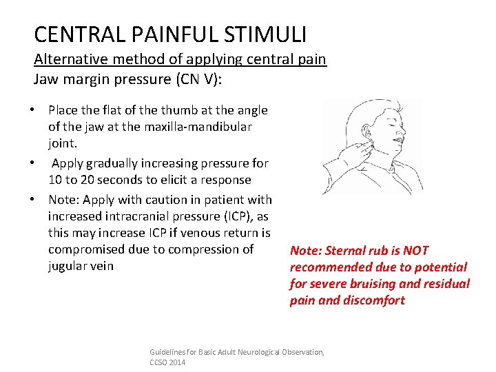 CENTRAL PAINFUL STIMULI Alternative method of applying central pain Jaw margin pressure (CN V):