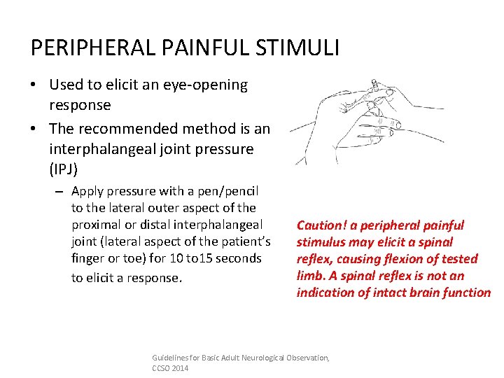 PERIPHERAL PAINFUL STIMULI • Used to elicit an eye-opening response • The recommended method