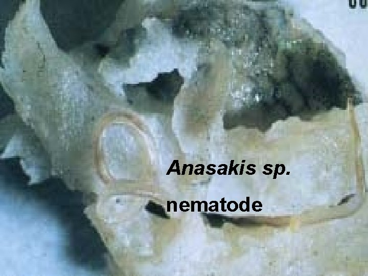 Anasakis sp. nematode 