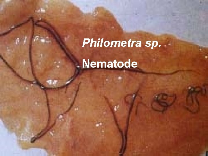 Philometra sp. Nematode 