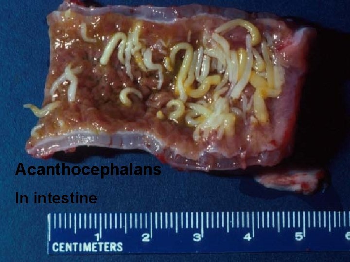 Acanthocephalans In intestine 