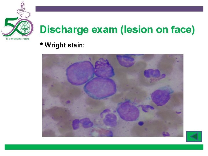 Discharge exam (lesion on face) • Wright stain: 