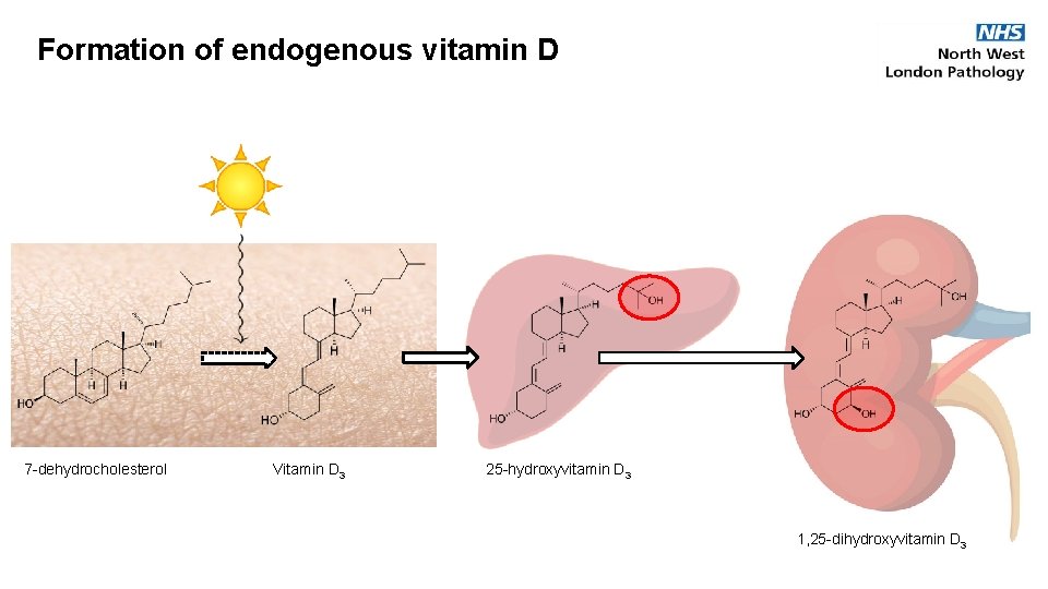 Formation of endogenous vitamin D 7 -dehydrocholesterol Vitamin D 3 25 -hydroxyvitamin D 3