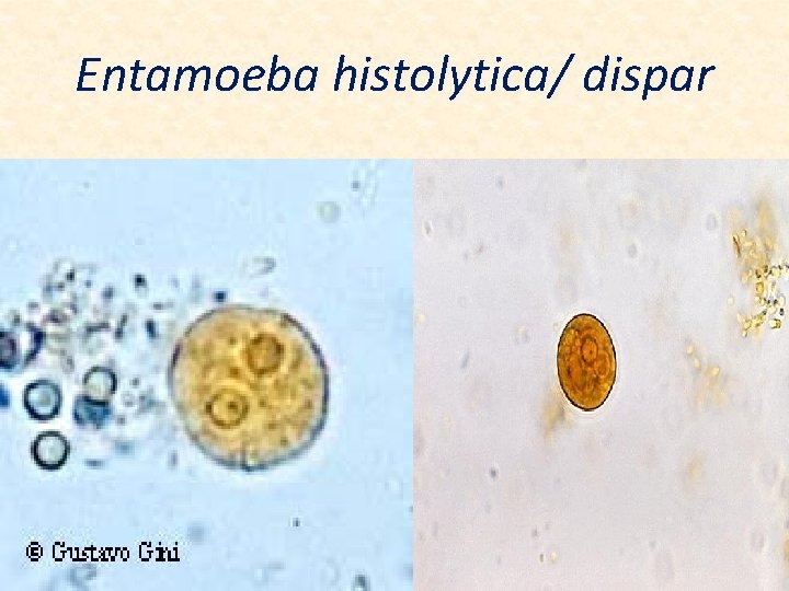 Entamoeba histolytica/ dispar 