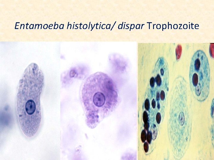 Entamoeba histolytica/ dispar Trophozoite 