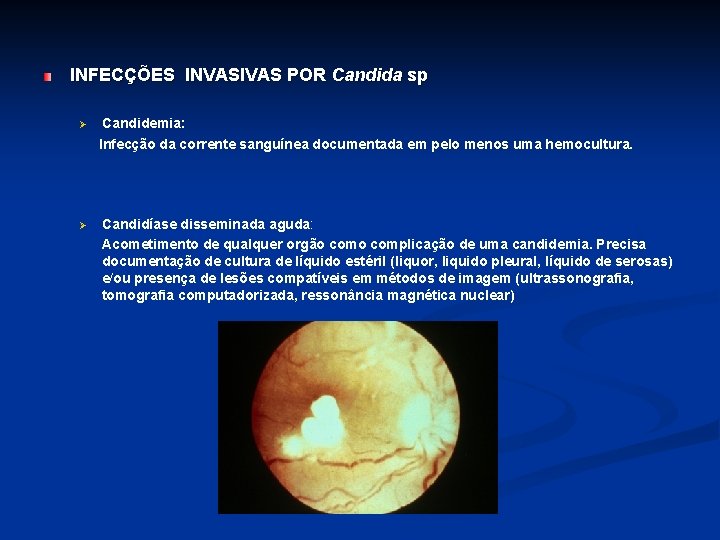 INFECÇÕES INVASIVAS POR Candida sp Ø Candidemia: Infecção da corrente sanguínea documentada em pelo