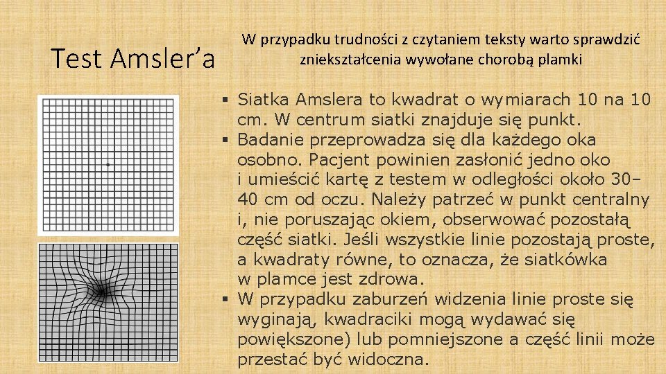 Test Amsler’a W przypadku trudności z czytaniem teksty warto sprawdzić zniekształcenia wywołane chorobą plamki