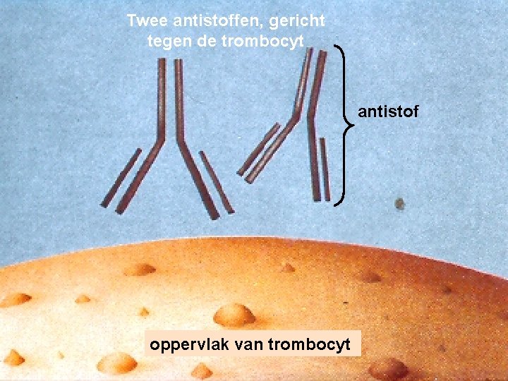 Twee antistoffen, gericht tegen de trombocyt antistof oppervlak van trombocyt Dept Hematology 