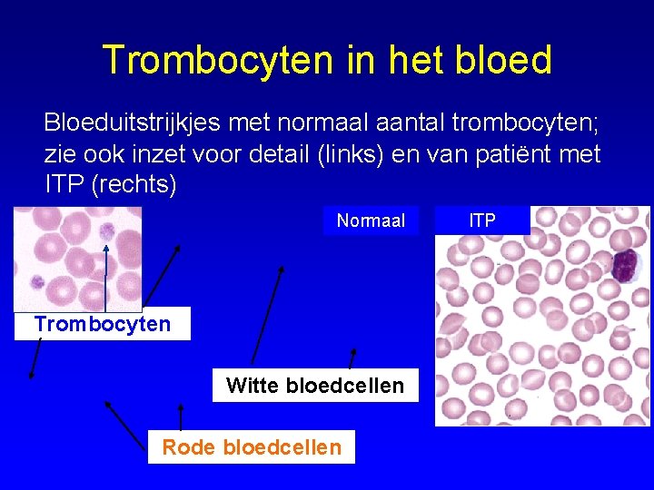 Trombocyten in het bloed Bloeduitstrijkjes met normaal aantal trombocyten; zie ook inzet voor detail