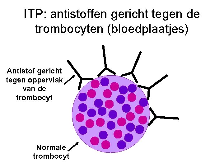 ITP: antistoffen gericht tegen de trombocyten (bloedplaatjes) Antistof gericht tegen oppervlak van de trombocyt