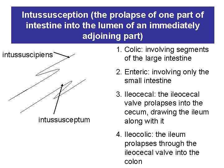 Intussusception (the prolapse of one part of intestine into the lumen of an immediately