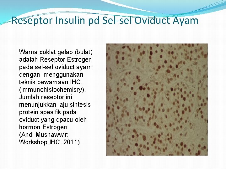 Reseptor Insulin pd Sel-sel Oviduct Ayam Warna coklat gelap (bulat) adalah Reseptor Estrogen pada