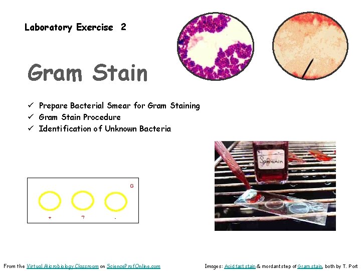 Laboratory Exercise 2 Gram Stain ü Prepare Bacterial Smear for Gram Staining ü Gram