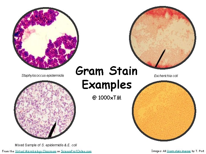Staphylococcus epidermidis Gram Stain Examples Escherichia coli @ 1000 x. TM Mixed Sample of