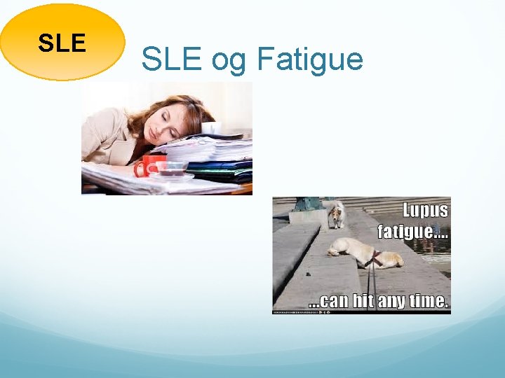 SLE og Fatigue 