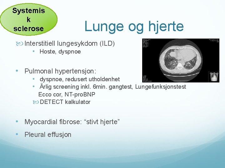 Systemis k sclerose Lunge og hjerte Interstitiell lungesykdom (ILD) • Hoste, dyspnoe • Pulmonal