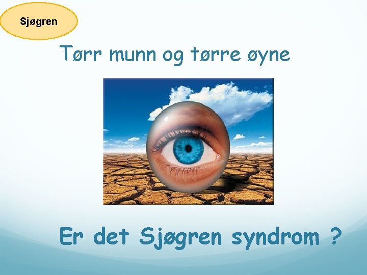 Sjøgren Tørr munn og tørre øyne Er det Sjøgren syndrom ? 