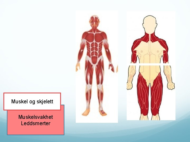 Muskel og skjelett Muskelsvakhet Leddsmerter 