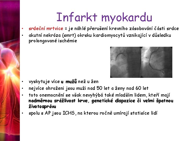 Infarkt myokardu • • srdeční mrtvice = je náhlé přerušení krevního zásobování části srdce