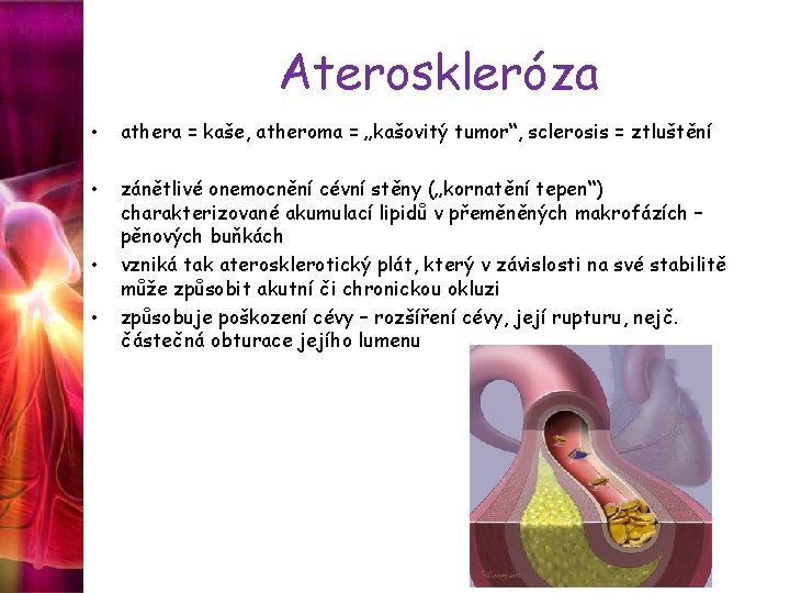 Ateroskleróza • athera = kaše, atheroma = „kašovitý tumor“, sclerosis = ztluštění • zánětlivé