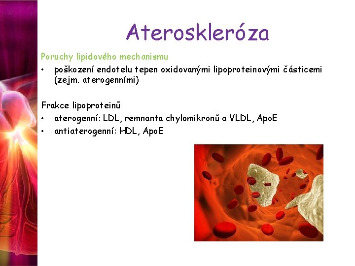 Ateroskleróza Poruchy lipidového mechanismu • poškození endotelu tepen oxidovanými lipoproteinovými částicemi (zejm. aterogenními) Frakce