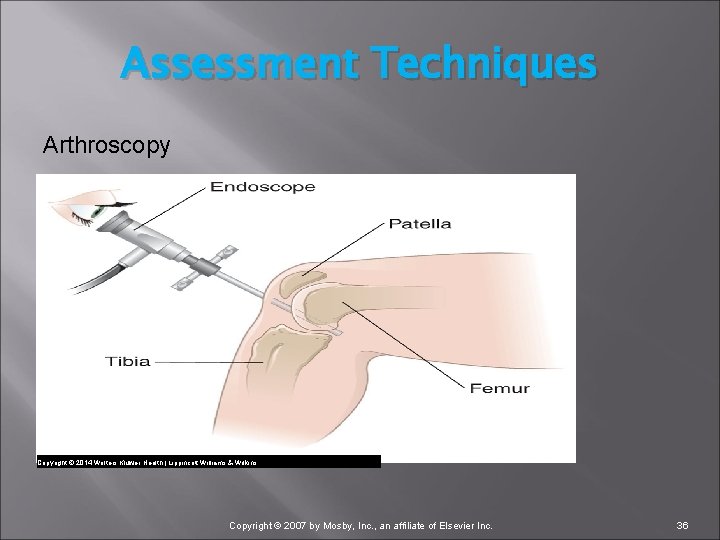 Assessment Techniques Arthroscopy Copyright © 2014 Wolters Kluwer Health | Lippincott Williams & Wilkins